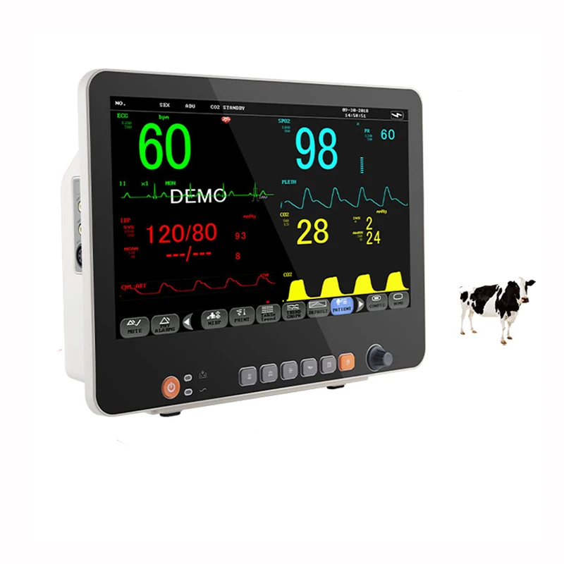 15.6 Inch 15.6 inch large screen Multi-parameter  monitor blood pressure testing Multi-parameter monitor