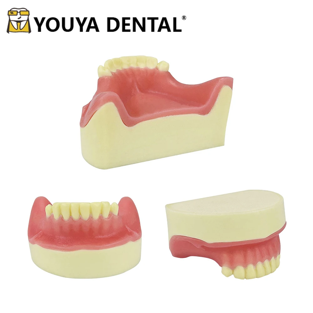 Dental Teaching Model Mandibular Deletion Implant Model for Dentist Student Studying Training Doctor-patient Communication Tool