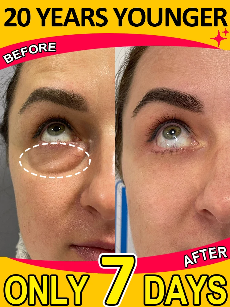 

Растворите проблемы вокруг глаз.