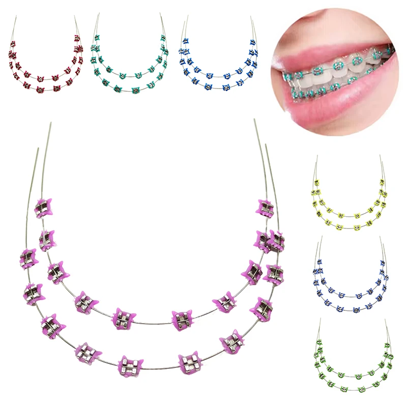 

2Pcs Colorful Temporary Tooth Decoration Cartoon Cat Dental Metal Braces Archwire Without Hooks Metal Bracket And Ligature Ties