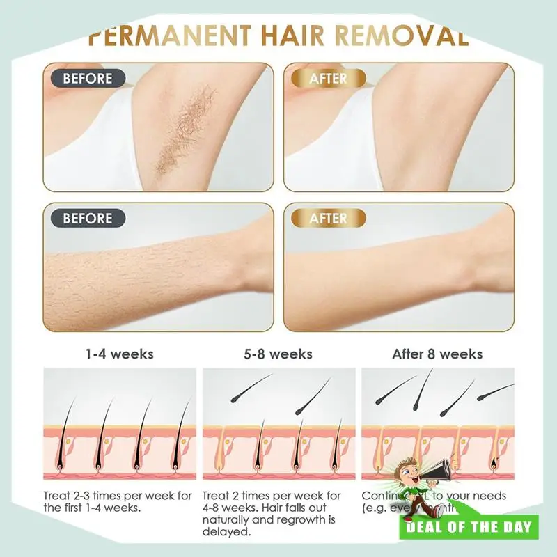 24-Hour Delivery Portable Handheld Hair Removal Device Full Body Painless Hair Removal Device Portable Full Body Hair Removal De