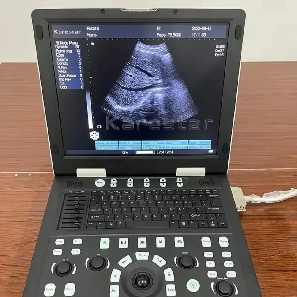 Portable Medical Ultrasound Machine Veterinary Instrument Sonar Device Ultrasound Machine for Human Animal Cattle Cow Horse Goat