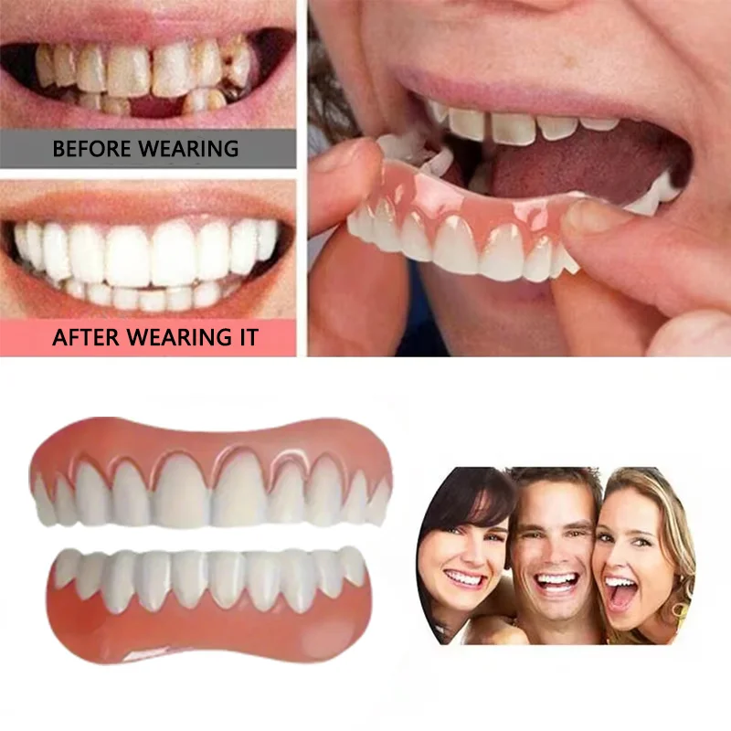 

Cosmetic Teeth Veneers Temporary Cosmetic Teeth Covering Set - Complete Smile Solution for Upper and Lower Teeth, Easy to Use & Clean, Braces-Style Cosmetic Overlay - Perfect Valentine's Day Gift