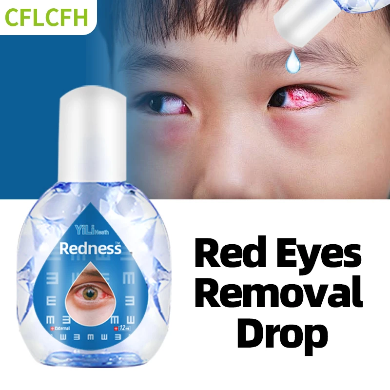 

Red Eyes Removal Treatment Eye Drop 12Ml Visual Fatigue Eye Discomfort Dry Eyes Pain Excessive Eye Use Protect Vision Care Drops