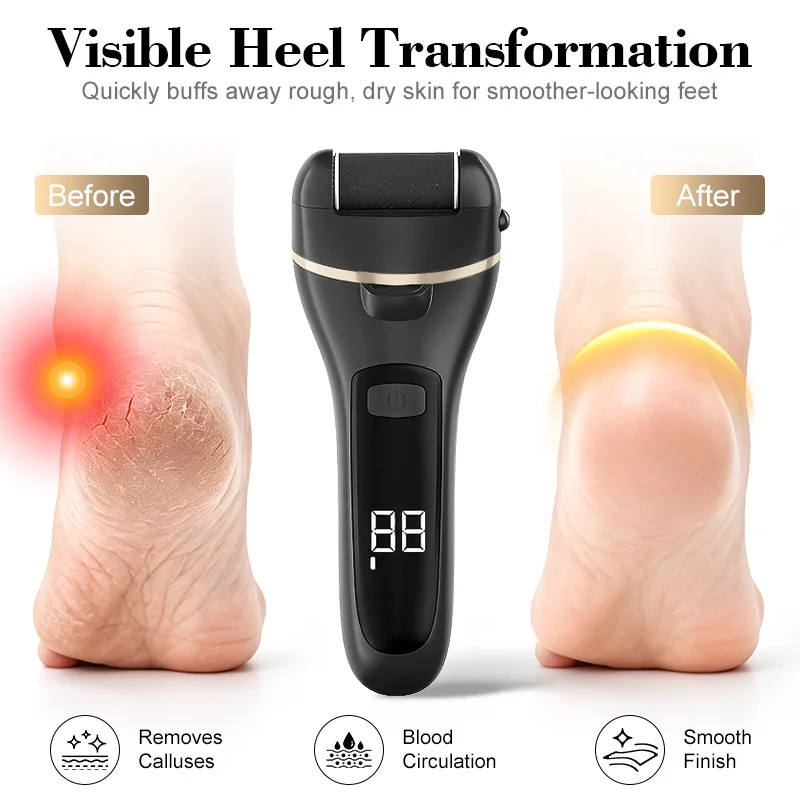 Electric Foot Callus Remover, USB Rechargeable Pedicure Tool, Portable, Ideal Gift for Mom, Girlfriend, Women