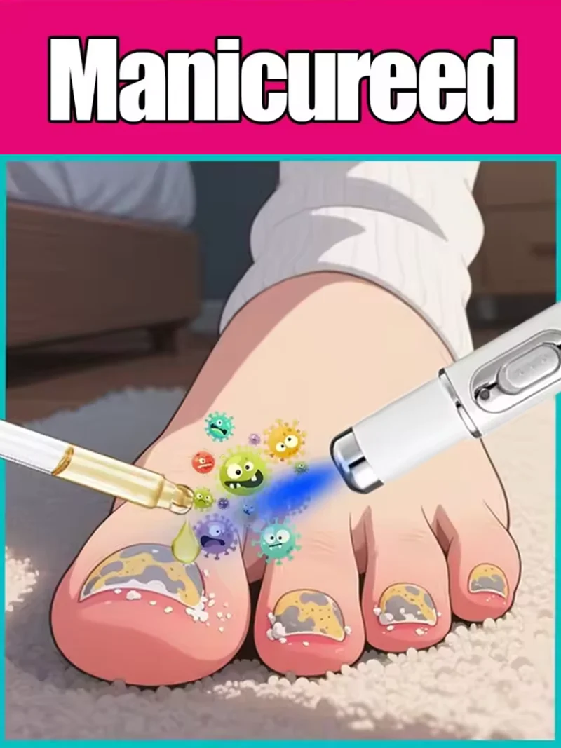 

Blue light pen quickly removes Manicure fungus, a best-selling Manicure care tool