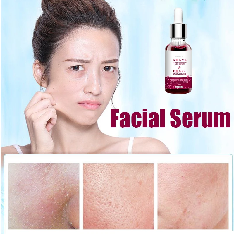 

Shrink Pores Serum Salicylic Fruit Acid Face Remove Blackheads Oil Control Gel Whitening Moisturizing Smooth Skin Care Products