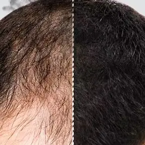 

20 г порошок для наращивания волос, черный натуральный уход за волосами, устойчивый к поту, утолщенный продукт для роста волос для истонченных волос, кожи головы