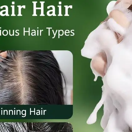 صابون شامبو عشبي من Platycladus يحارب بقوة قشرة القشرة ويقوي جذور الشعر والتحكم الفعال في الزيت ويمنع تساقط الشعر شامبو صلب #2