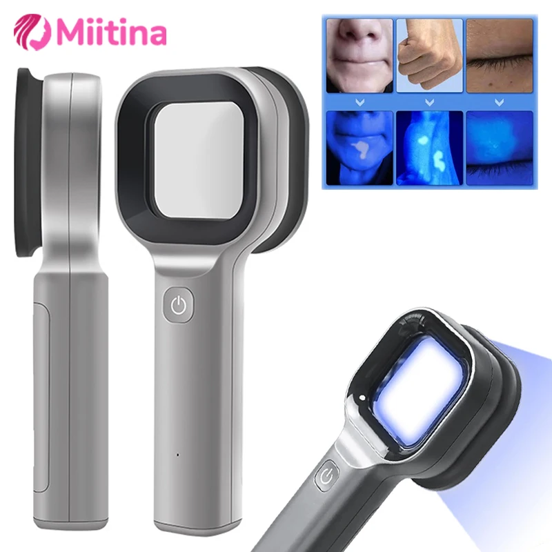 

Woods Lamp Skin Analyzer Skin UV 365 Nanometer UV Irradiation Equipment Face Beauty Skin Care for Pet Cat and Dog