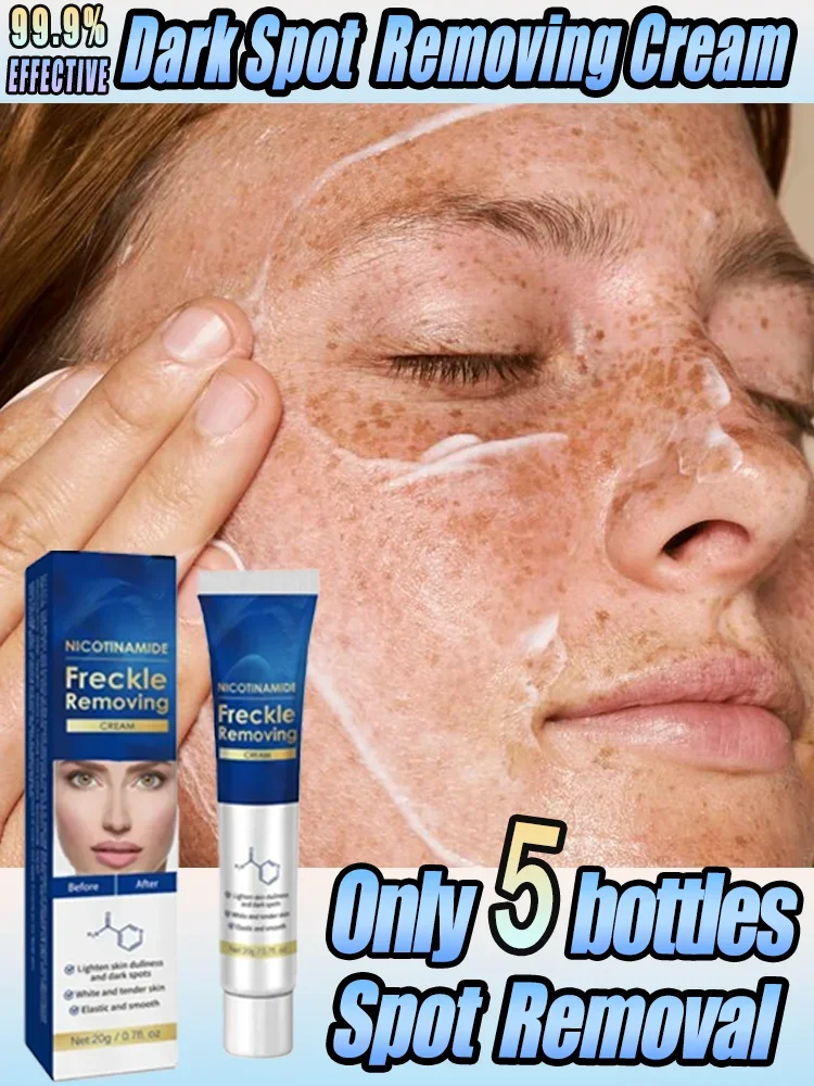 

Effictive Dark Spot Remover cream for Face Removing Freckle Melasma Chloasma Senile Plaques Sunburn Cyasma Chorioplaque Freckle