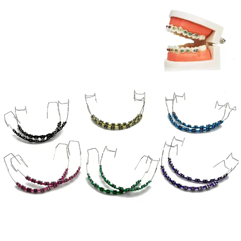 

Tooth Decoration With Metal Wires Metal Bracket Orthodontic Ligature Ties