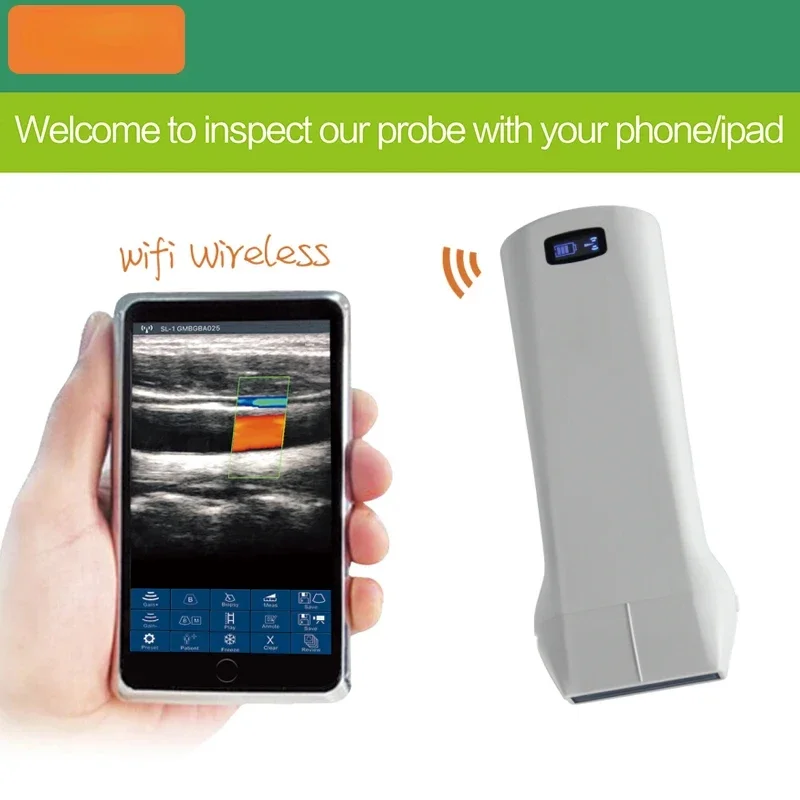 

Color Doppler Wireless Ultrasound Scanner Probe Linear Probe ultrasound scanner Veterinary useultrasound instruments