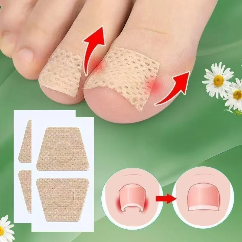 Toenail Fungus Patch Nail Repair Patches Nail Ingrown Correction Stickers for Discolored or Damaged Nails Sticker Toenail Care