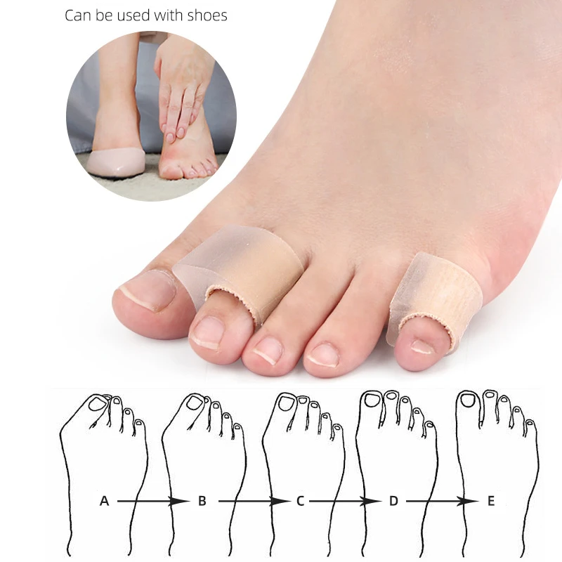 Mathiateur d'hallux valgus en silicone, outil de soin des pieds, séparateur d'oignon, écarteur de pouce, ration du pouce, redresseur, orthèses, gel, 7 paires