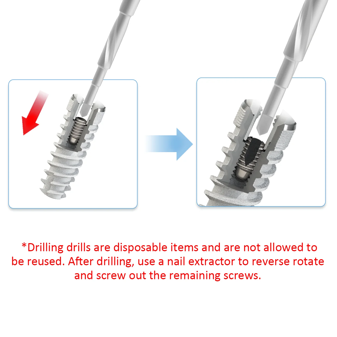 Dental Implant Broken Screw Removal Kit Surgical Remover Extraction Drill Driver Guide Implant Restoration Tools