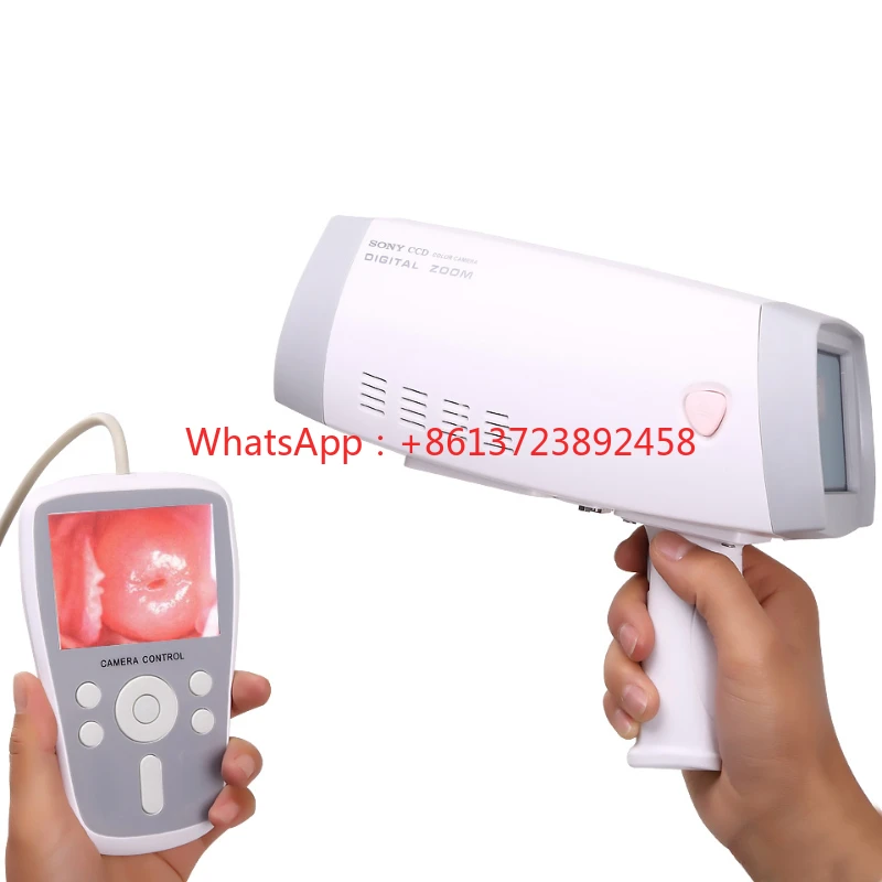 HKN-2000 Handheld Digital Video  for Gynecology