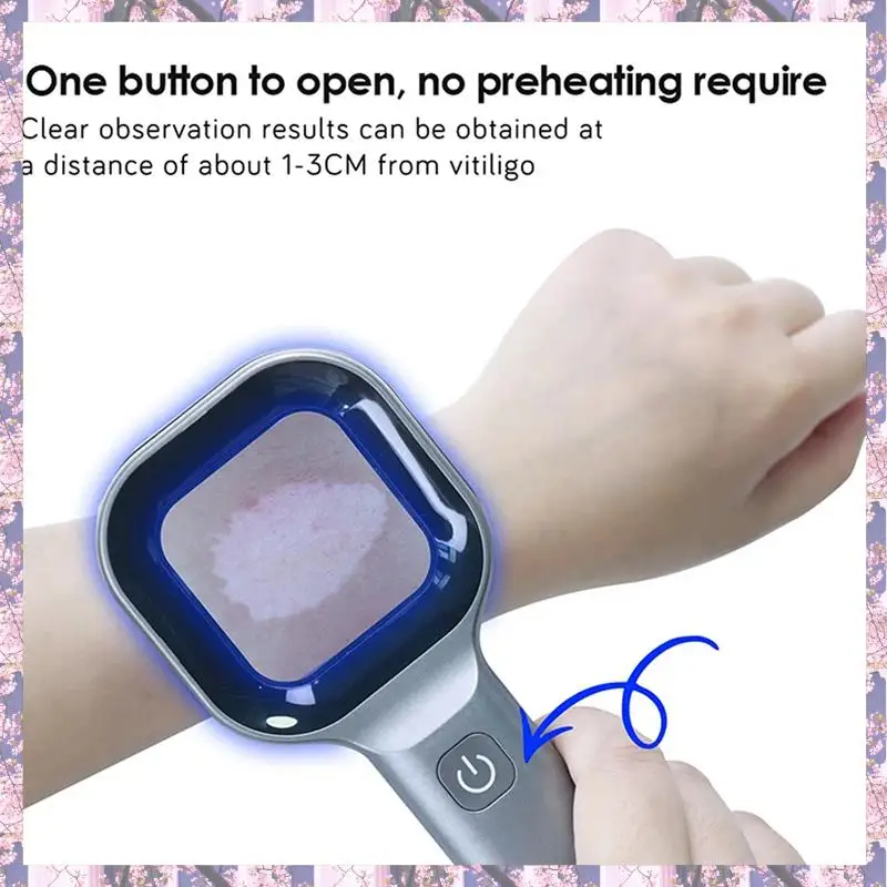 L73A 2025-3X lámpara de madera analizador de piel analizador de belleza de salón Facial portátil lámpara de madera UV para pruebas de análisis de cuidado de la piel