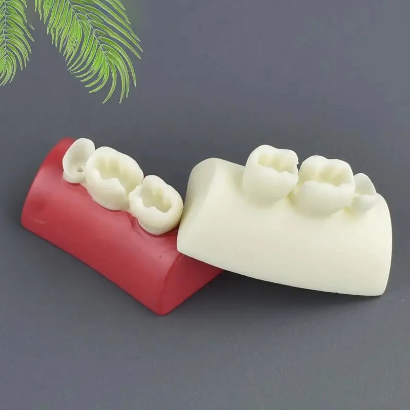 ＆1Pc Oral Filling Model Dental Inlay Exercise Model Block Filling Exercise Typodont Resin Materials For Dentistry Teaching Stud