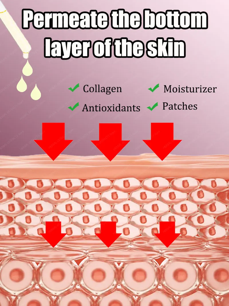 

Acne Remover Cream Anti Pimples