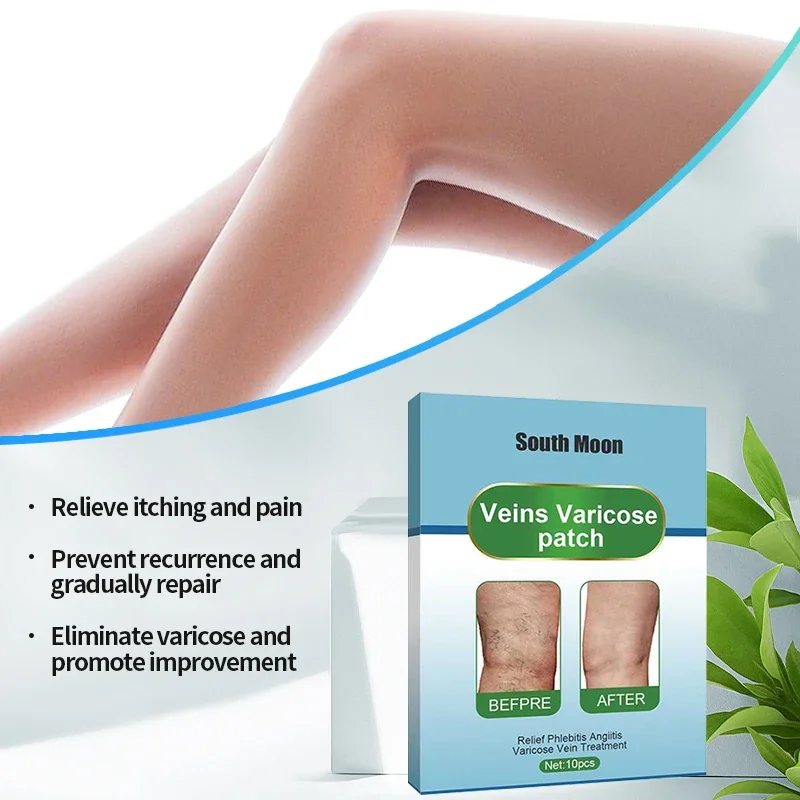 50Pcs Varicose Veins Relief Patch Spider Leg Vasculitis Phlebitis Treatment Varicosity Angiitis Legs Dilated Plaster Foot Care