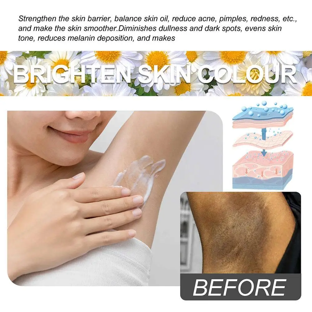 30g Face Body Brightening Cream Thigh Underarm Inner Improve Skin Care Brighten Lightening Nourishing Gentle Lotion H0U0