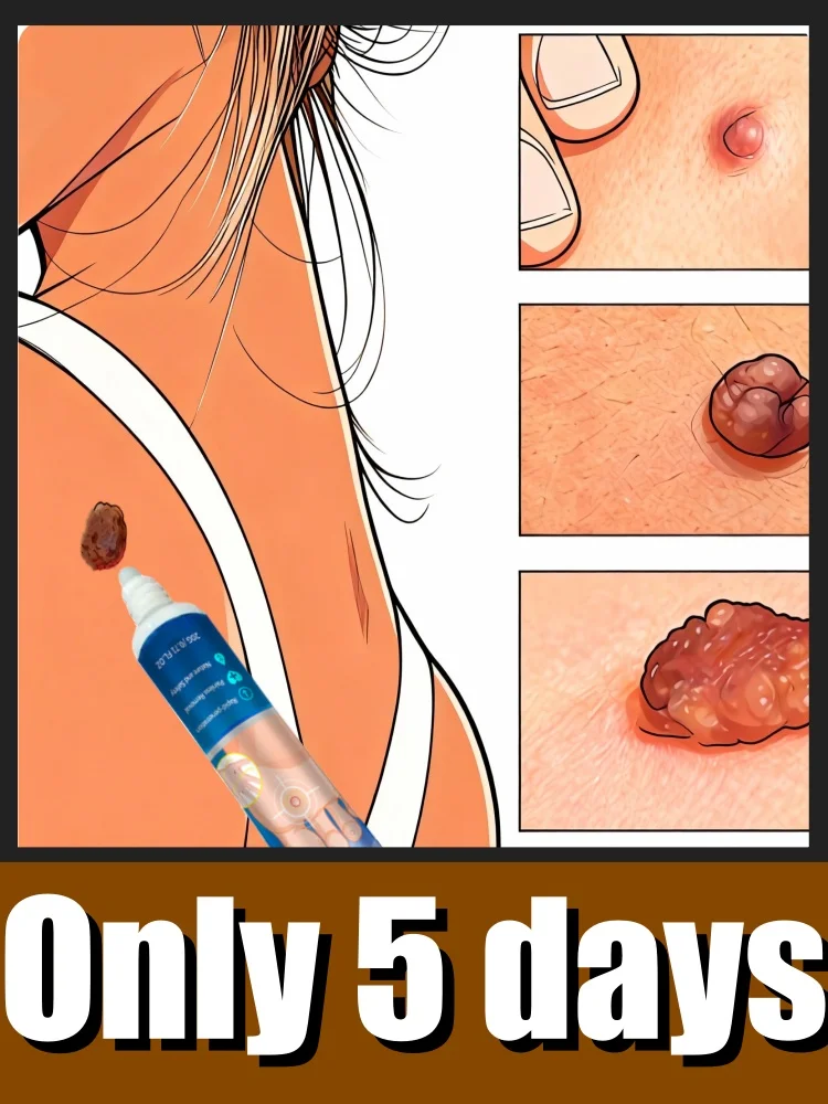 スキンケア製品、ユニセックス：皮膚の成長を7日以内に解消。