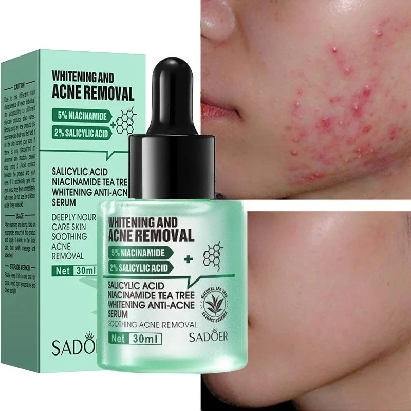 

Acne Removal Whitening Serum Effective Fade Acne Spots Repair Product Control Moisturizing Shrink Pores Acne Treatment Skin Care