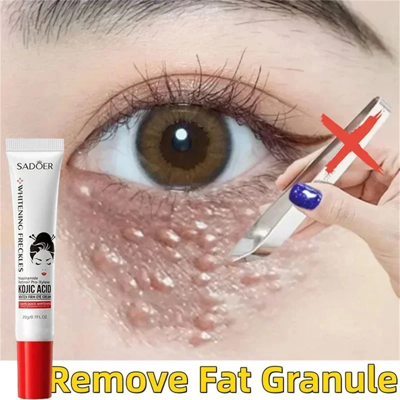 Fat Granules Remover Eye Cream Anti-Puffiness Anti Inflammatory Firm Cream Reduce Dark Circles Fade Fine Lines Repair Barrier Sk