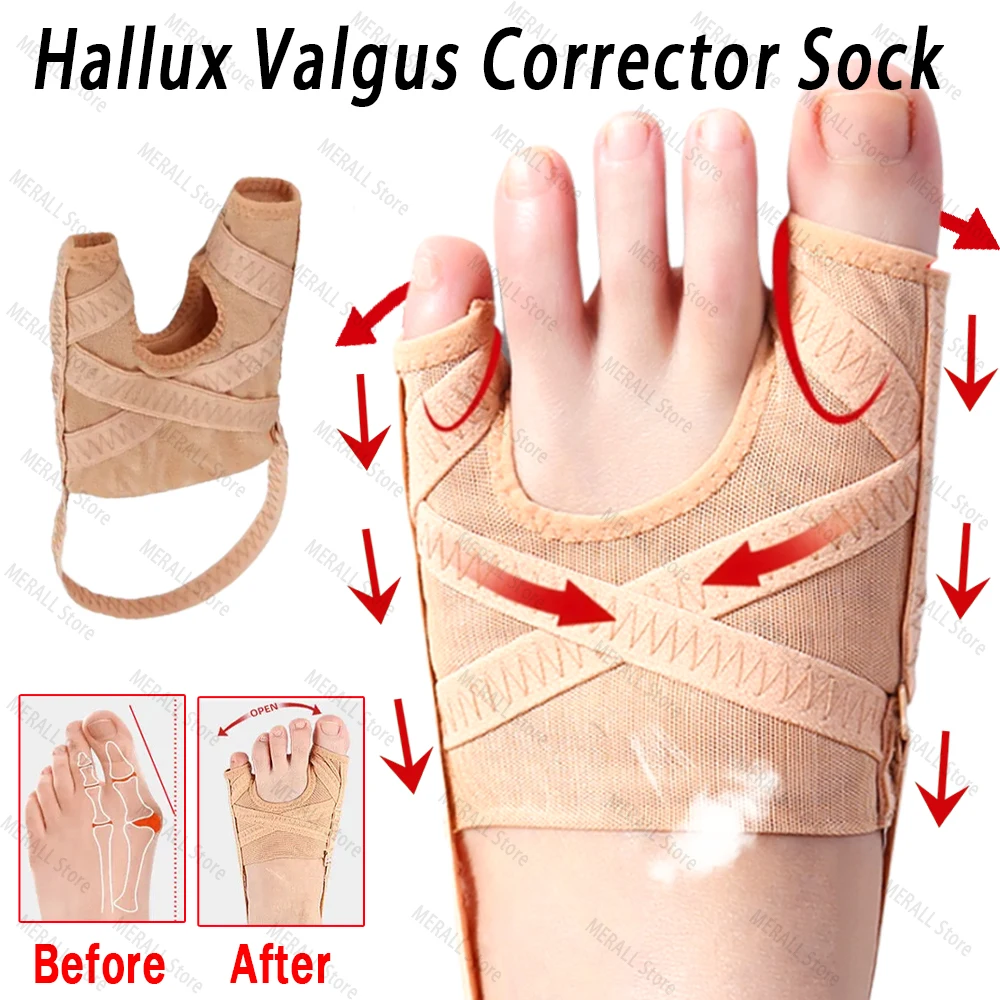 Fabric Bunion Corrector Breathable Adjustable Hallux Valgus Sleeve Spacer Separator Toe Corrector Sports Bunion Socks Running