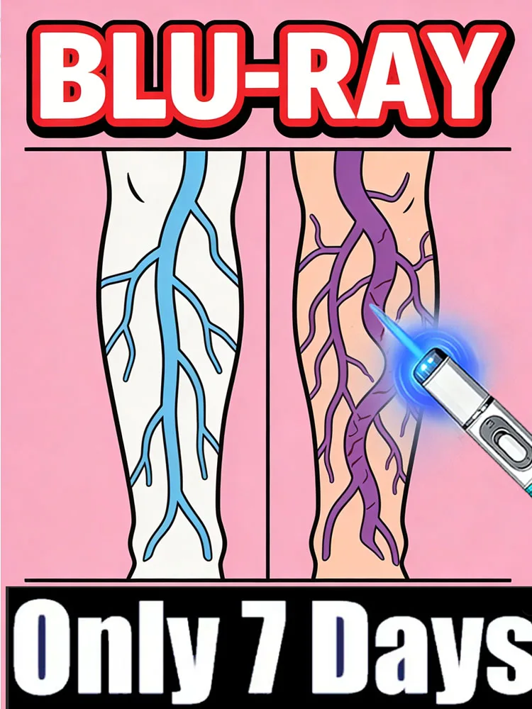 Blue light pen, Protecting your health. Cheonwon mart free shipping