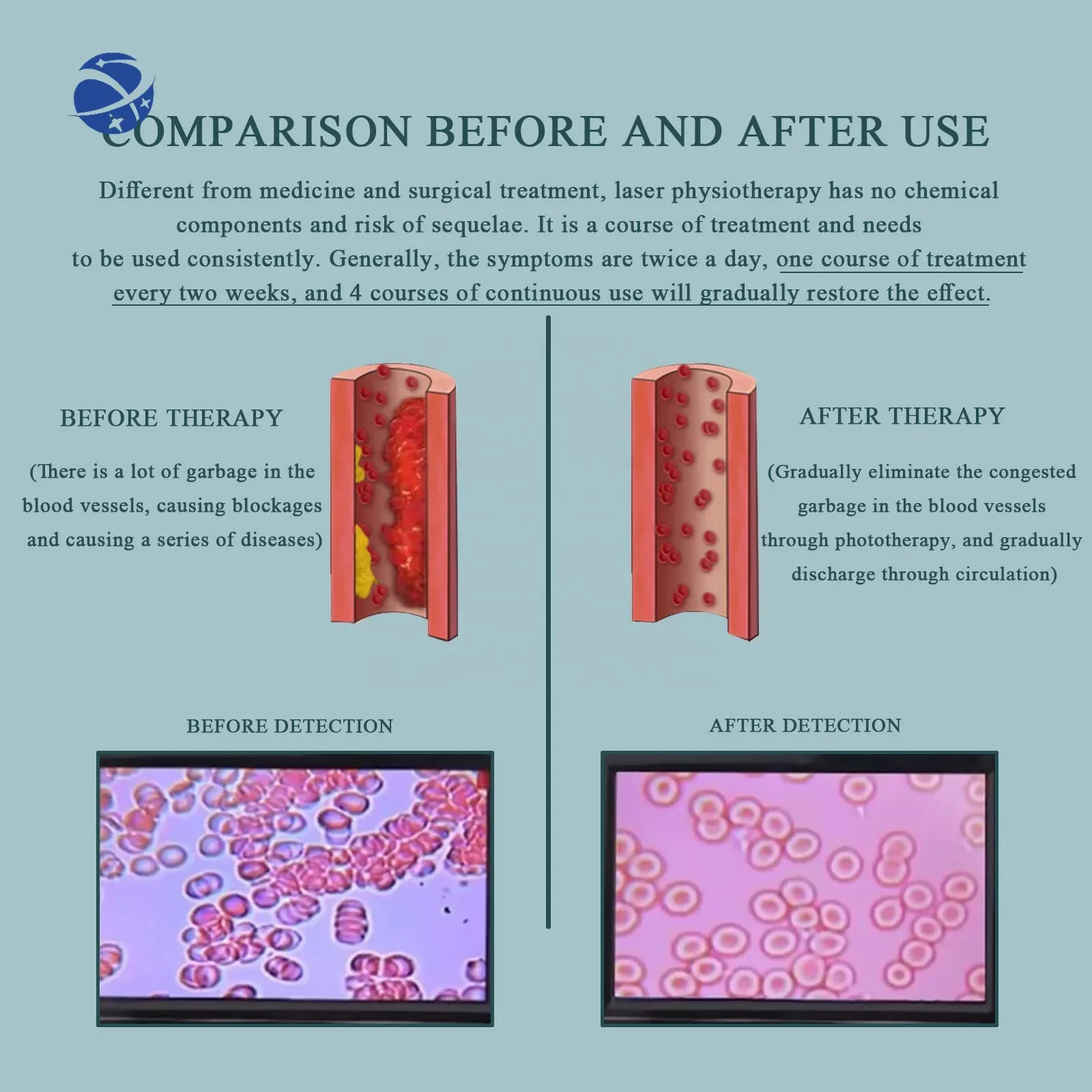 TCM Acupuncture Naturally Lower Blood Pressure Medical Device Reduce Blood Sugar 650nm Laser Therapy Watch