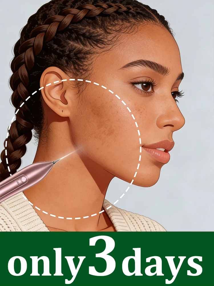 

Горячая новинка 2026 года: лазерный прибор для удаления пигментных пятен на лице, унисекс