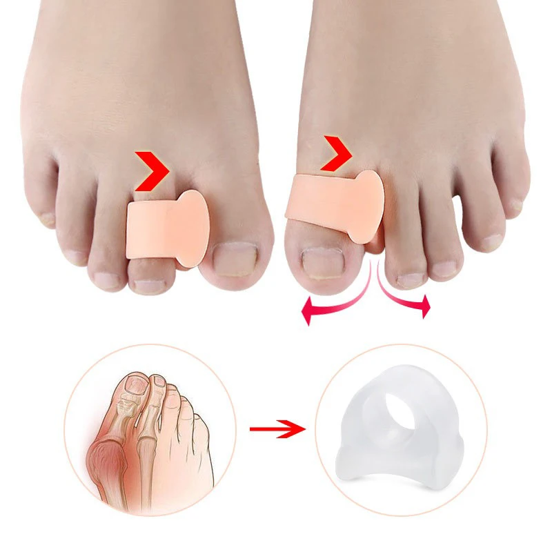 Mathiateurs en gel souple pour hallux valgus et orteil marteau, outil de soins des pieds orth4WD, 1 paire, 2 paires, 5 paires