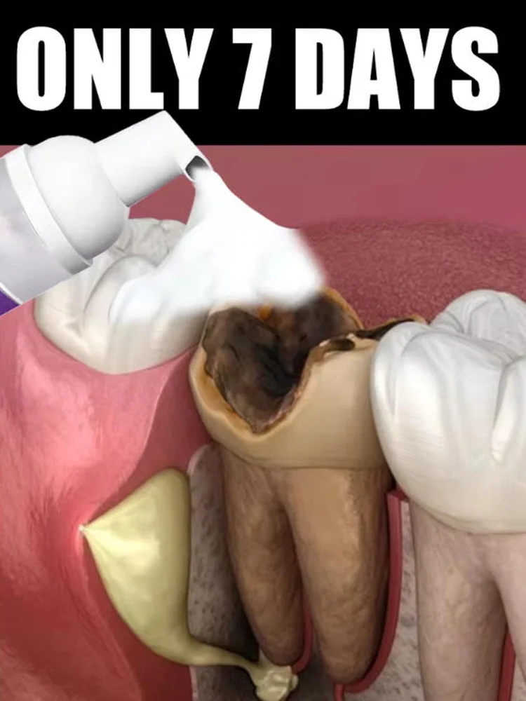 2026 Hot Products,Teeth cleaning care tools,free shipping,oral foam