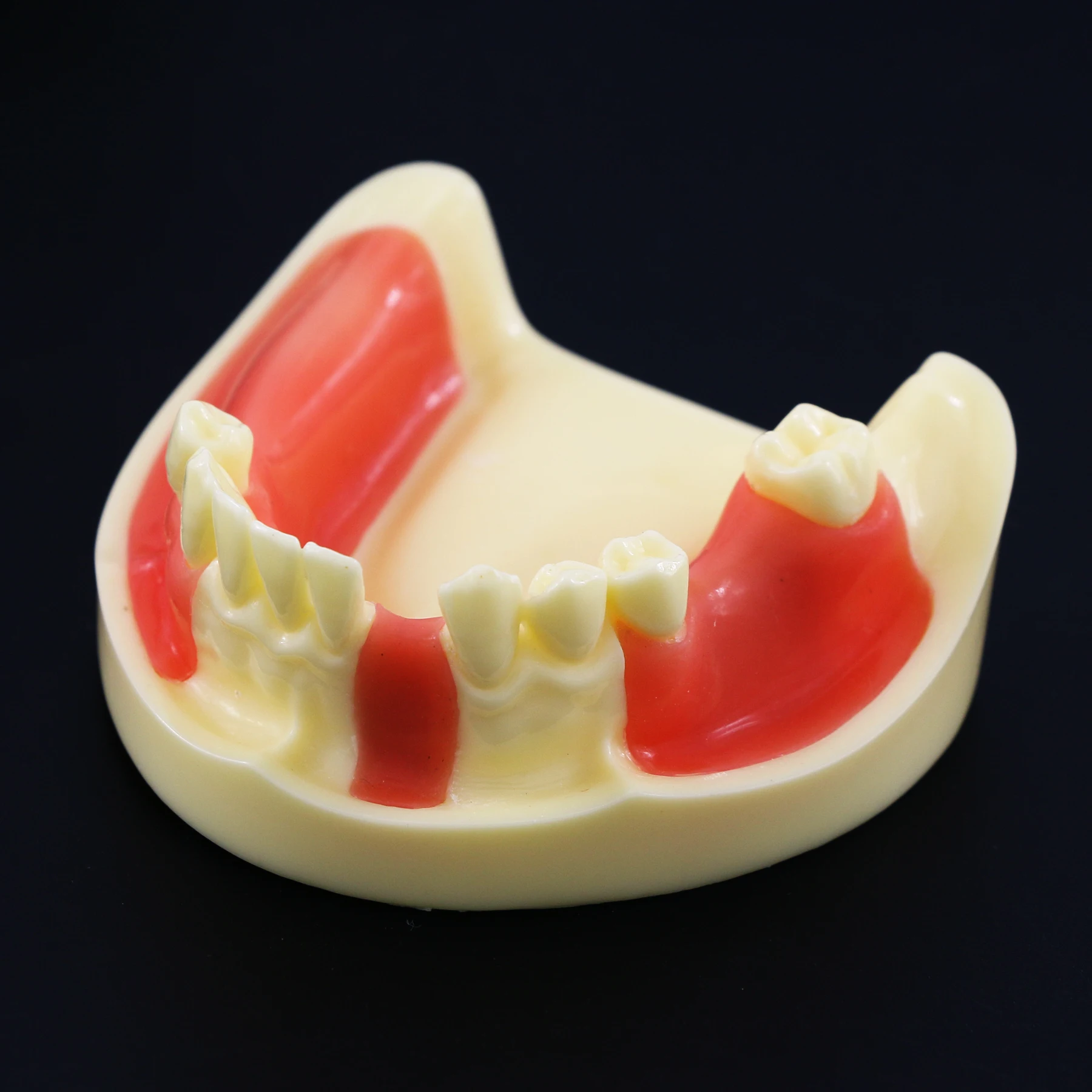 Dental Model  Mandibular Jaw Implant  Study Education Teach with Gingiva for Flap and Drilling Practice