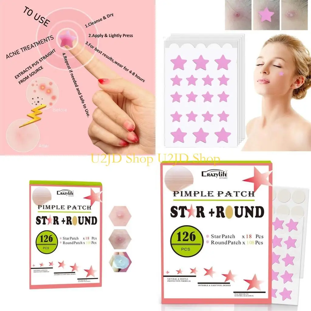 U2JD 여드름 패치 보이지 않는 여드름 컨실러 흡수 커버 패치 안면 검은 피부 관리