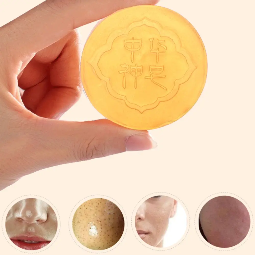 

Effective Body Whitening Soap Knees Bleaching Deep Clean Chicken Skin Removal Soap White Care Products Skin Care