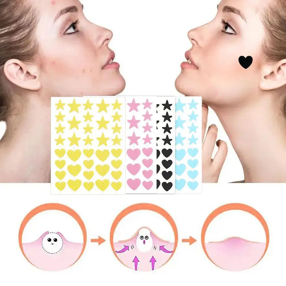 1 Sheet Of 36PCS Star Pimple Patch Acne Colorful Invisible Acne Removal Skin Care Stickers Concealer Face Spot Beauty Makeup Too