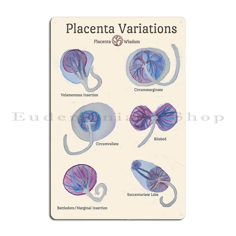 Placenta Variations Teaching Metal Sign Wall Mural Pub Club Create Decoration Tin Sign Poster