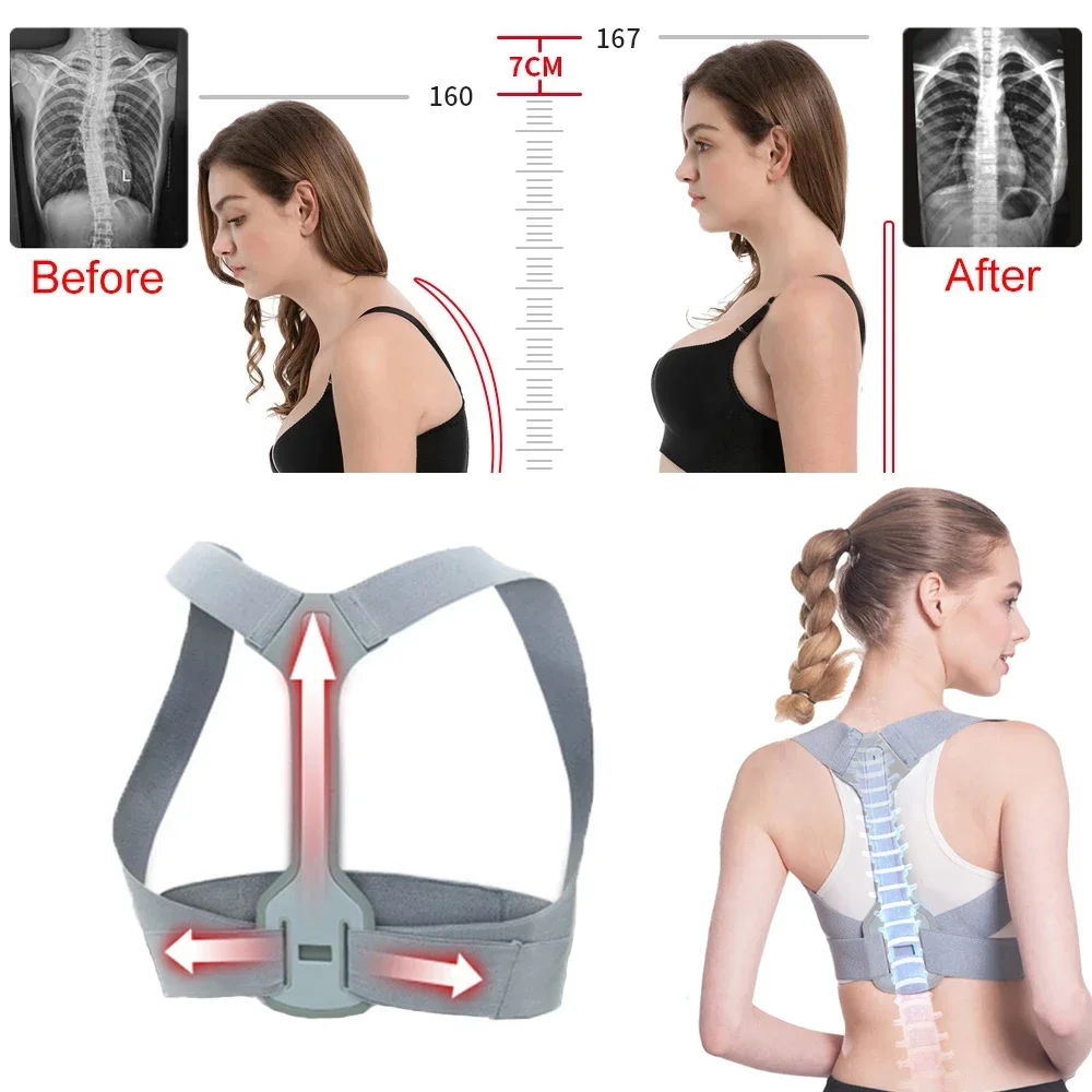 Adjustable Back Shoulder Posture Corrector Belt Clavicle Spine Support Brace Reshape Body Health Fixer Tape corrector de postura