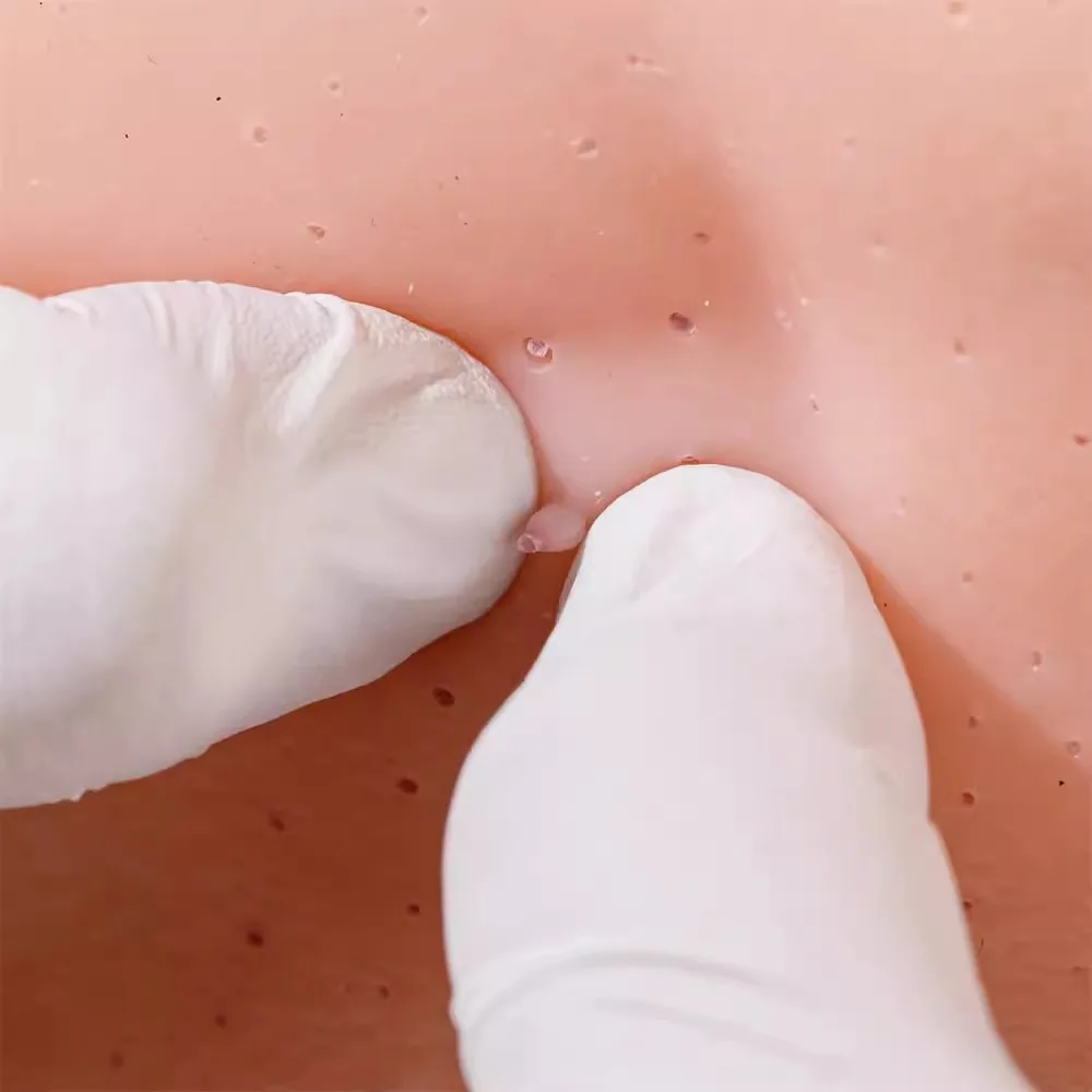 Tête de Mannequin en Silicone écologique, Ultra réaliste, Unique, conception de points noirs, nez de fraise, Simulation pour boutons, sciences médicales