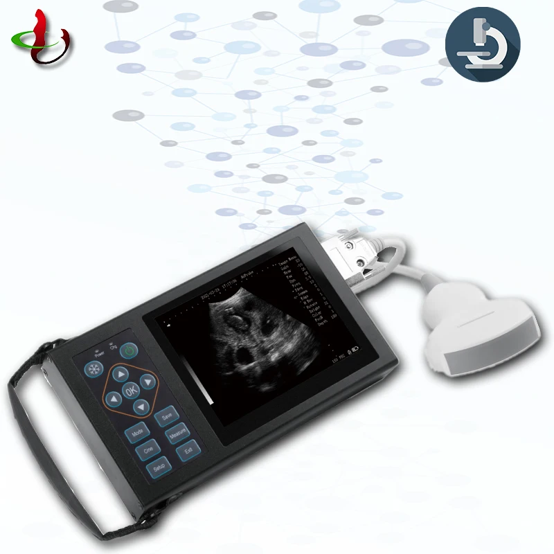 

Professional portable veterinary ultrasound machine b ultrasound diagnostic system