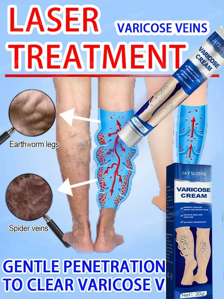 

Cream leg skin irritates and soothes venous tension