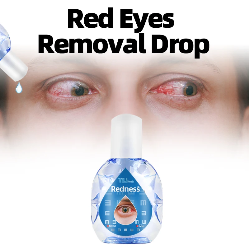 

Red Eyes Treatment Eye Drop Apply To Eye Discomfort Visual Fatigue Dry Eyes Pain Excessive Eye Use Protect Vision Care Drops