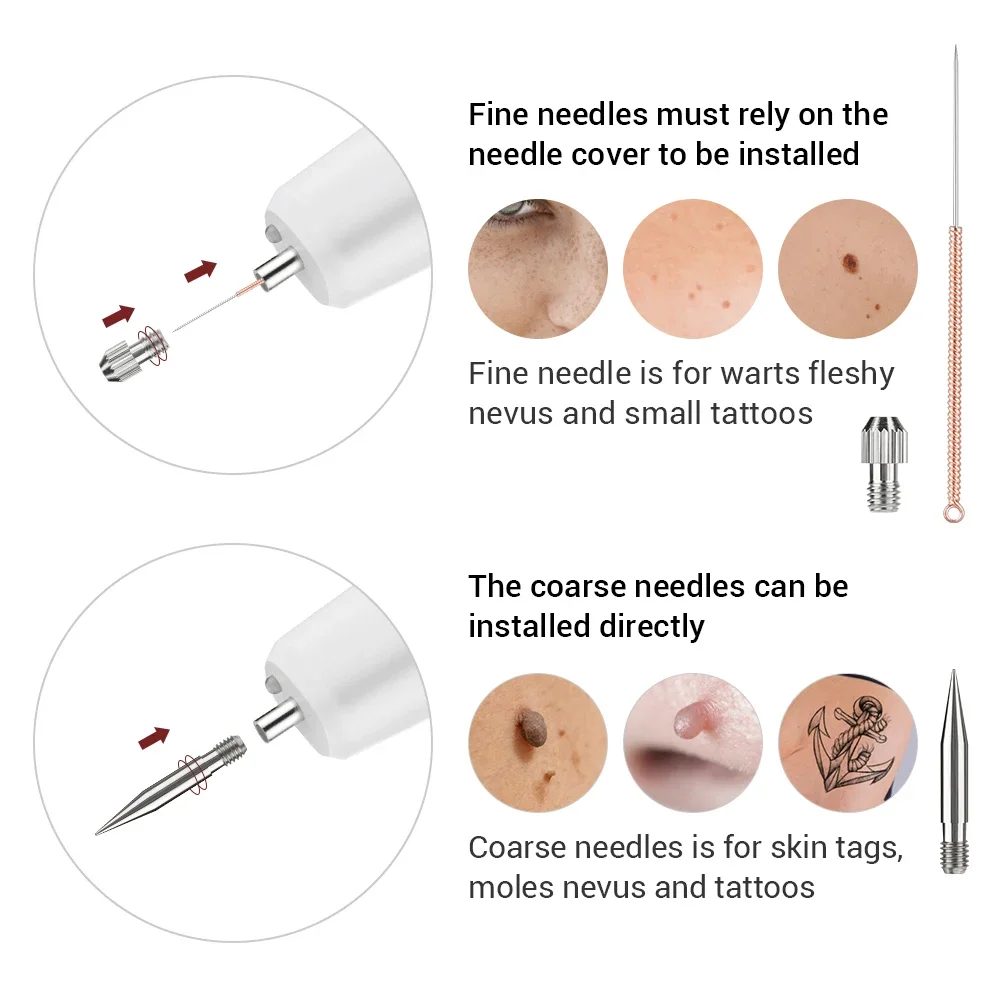Schoonheidssalon Vlekverwijderingspen Molpen Huishoudelijk Mini Draagbaar Verzorgingsapparaat Tatoo Verwijder Pen Mild Zonder de huid te stimuleren