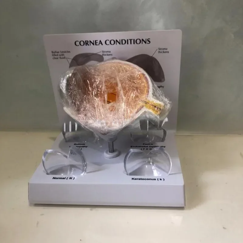 Modello per occhi Modello per malattie cororneali Specifica del libro di testo per l'insegnamento medico 12x10x8 cm