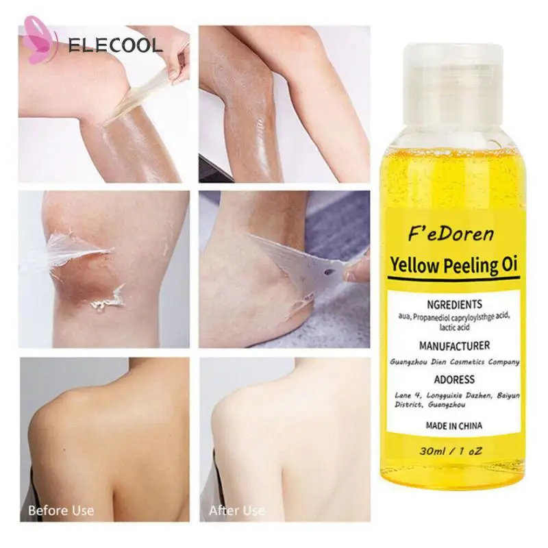 Yellow Peeling Oil Exfoliating Deep Cleaning Section Exfoliating Remove Dead Skin Smooth Melanin Even Bright Body Skin Care New