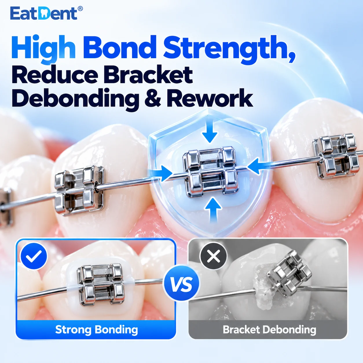 Dental Orthodontic Light Cured Adhesives Braces Glue Kit Etchant Acid Gel Light-Cure Paste Primer For Bonding Brackets Braces
