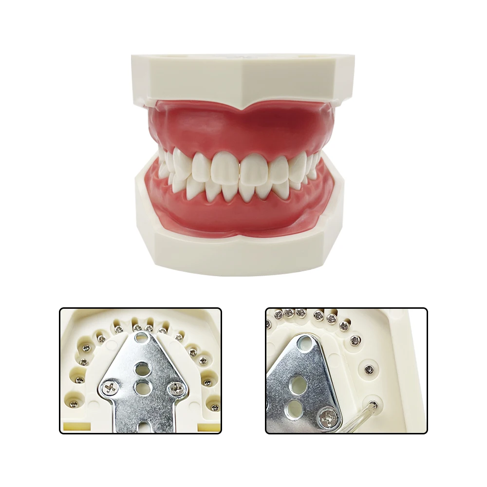 28/32 Removable Typodont Soft Gum Dental Model FE/DP Jaw Frame Is Suitable For Dental Students To Learn Practical Training Demo